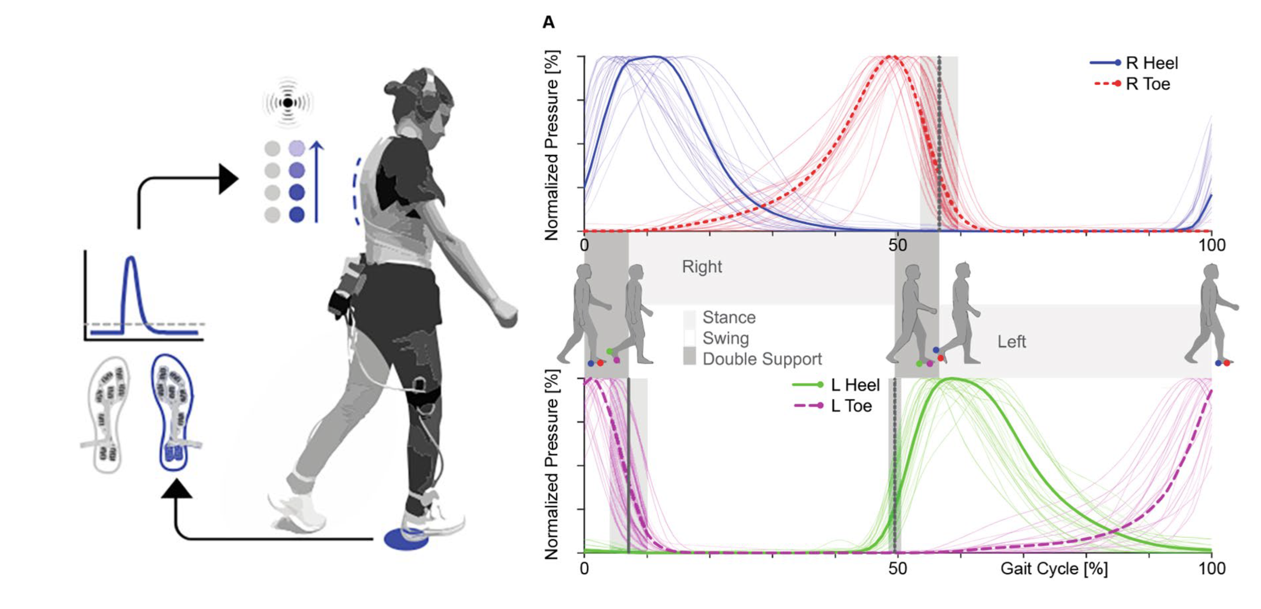 Image of the FeetBack study setup and spatiotemporal gait parameters