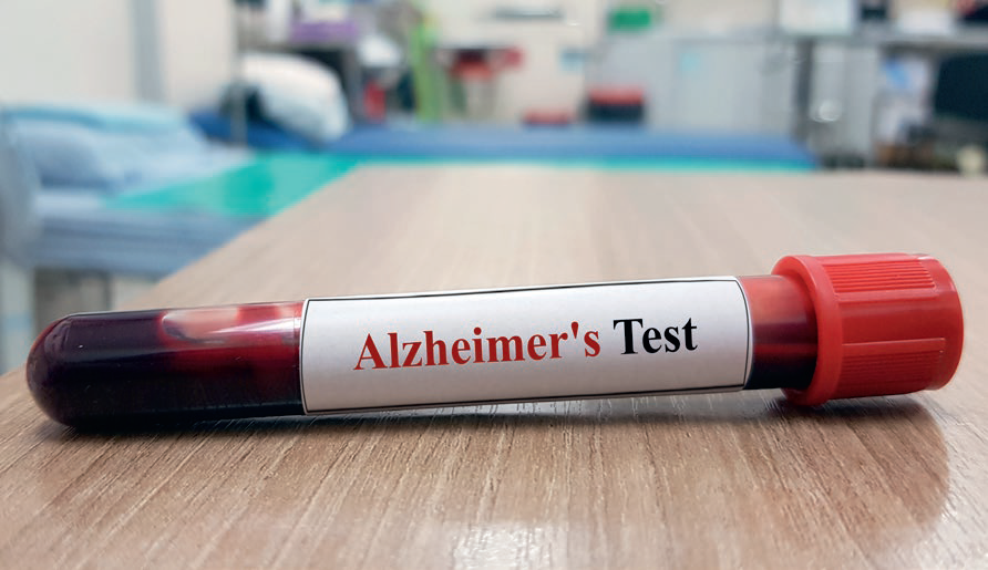 échantillon test Alzheimer 