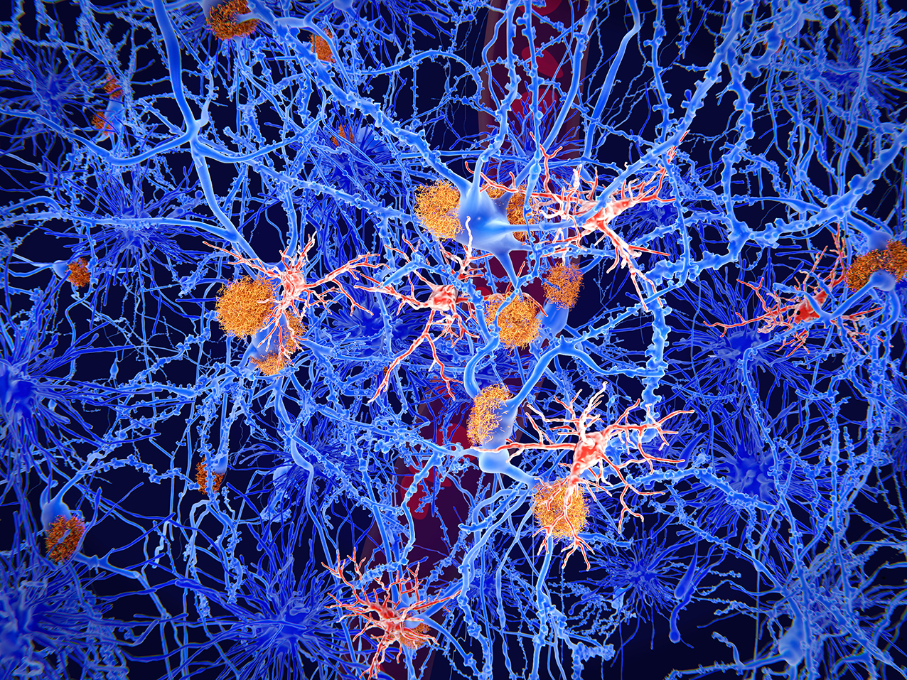 Microglia cells, in red