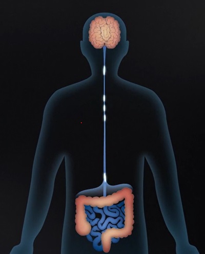 microbiote et Alzheimer