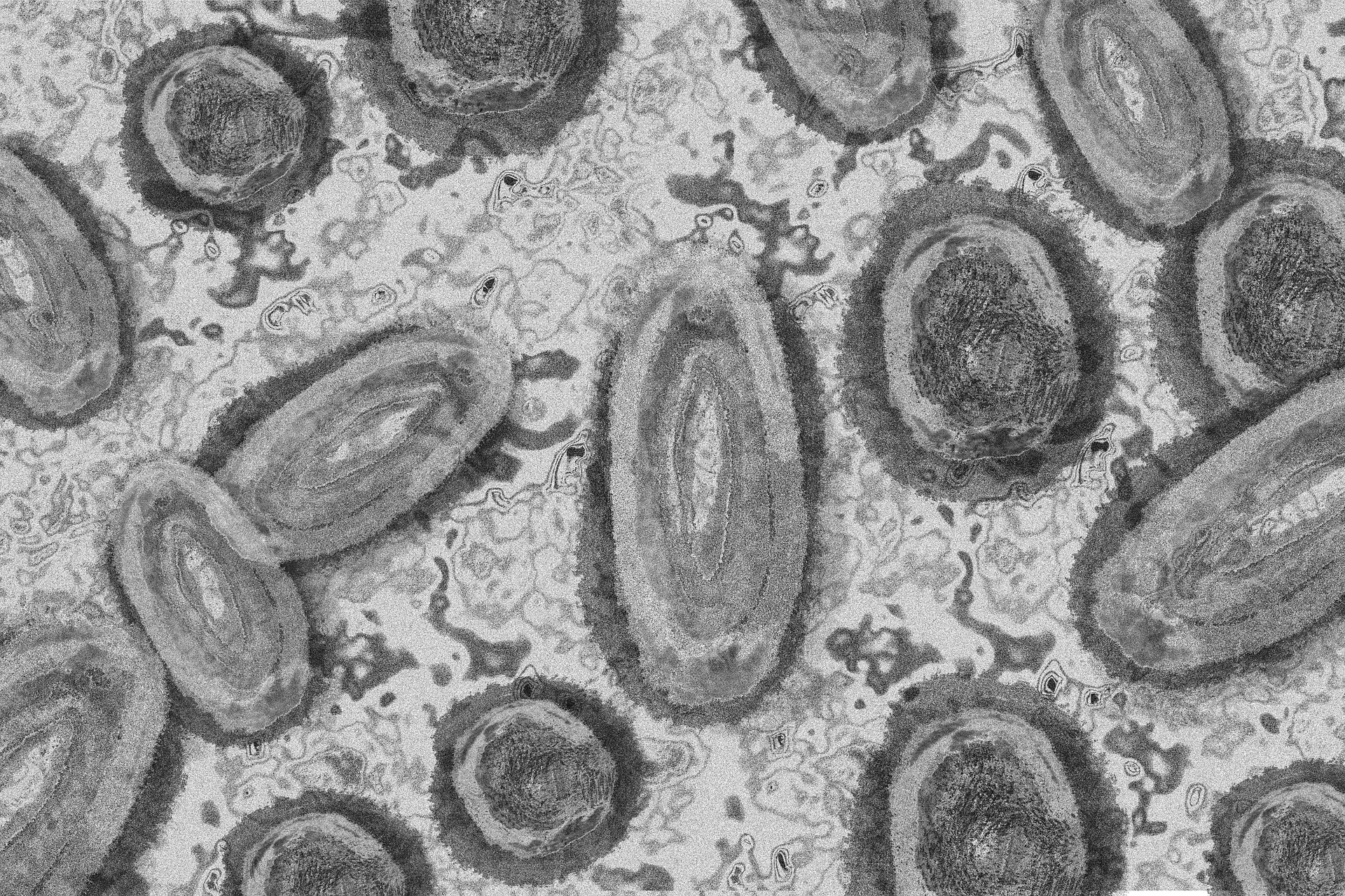étude scientifique internationale sur la variole du singe