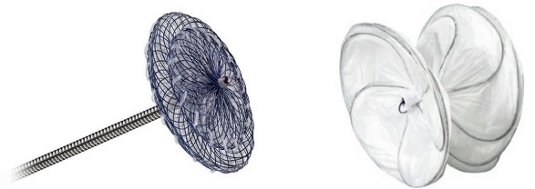 Amplatzer™ PFO et Gore® Cardioform