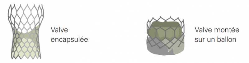 valves artificielles