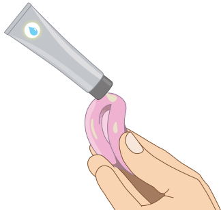 pose d'un pessaire -étape 1