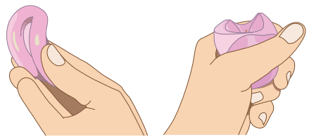 pose d'un pessaire -étape 2