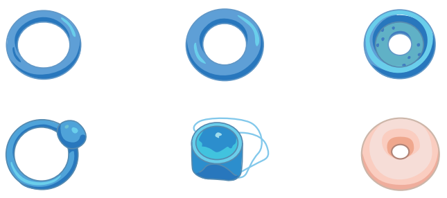 différents types de pessaire