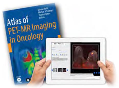 [img]Publication du premier Atlas d’imagerie  hybride PET-IRM[/img]