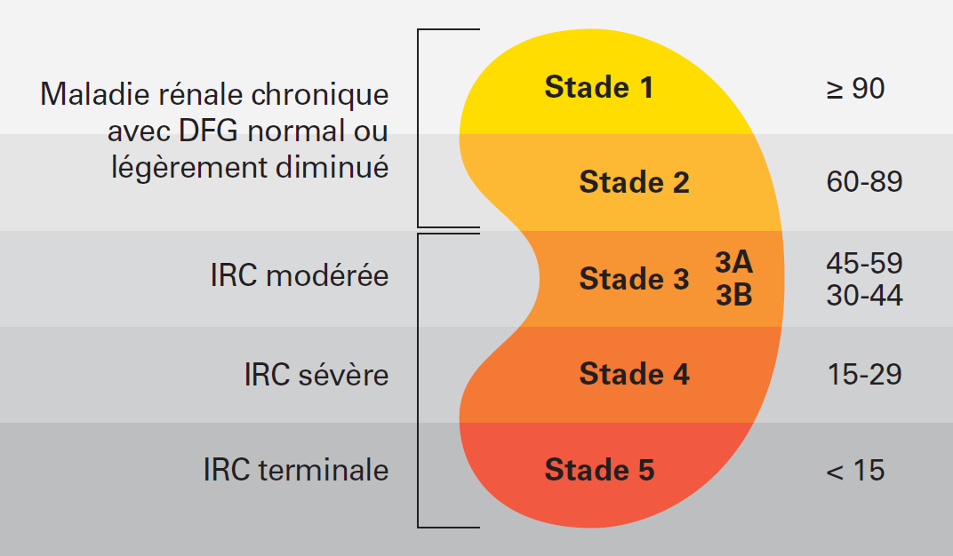 Les différents stades d’insuffisance rénale en fonction du taux de filtration glomérulaire. 
