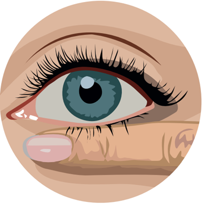 Massez la paupière inférieure du bas vers le haut