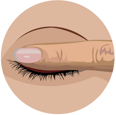 Massez la paupière supérieure du haut vers le bas