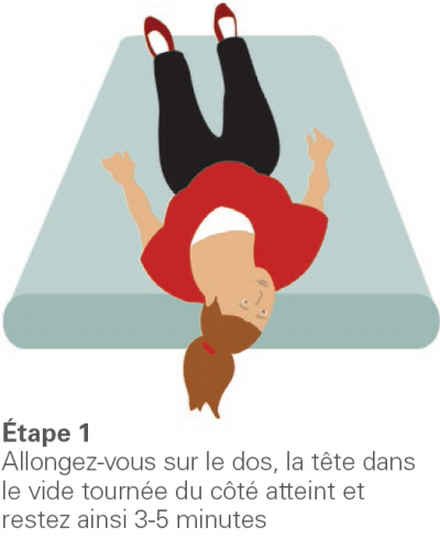 La manoeuvre d’Epley - étape 1