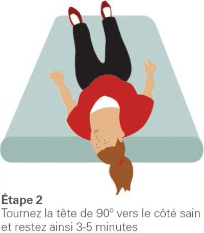 La manoeuvre d’Epley - étape 2