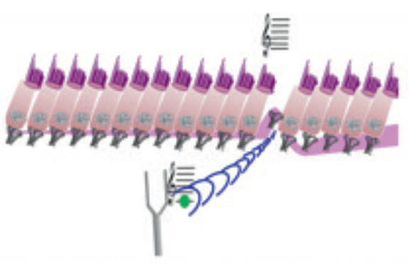audition défaillante