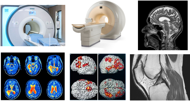 IRM - radiologie médicale