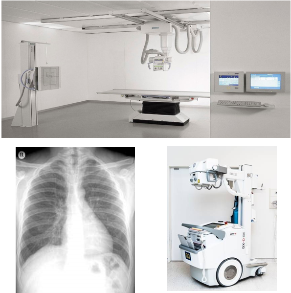 radiographie - radiologie médicale