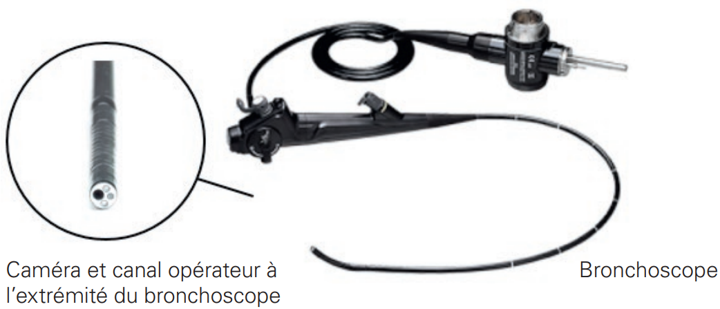 Bronchoscope
