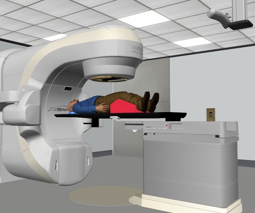 Représentation en 3D d’une salle de traitement.