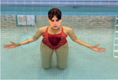 Rééducation en piscine