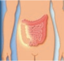 dérivation urinaire continente cutanée