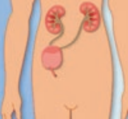 dérivation urinaire continente cutanée