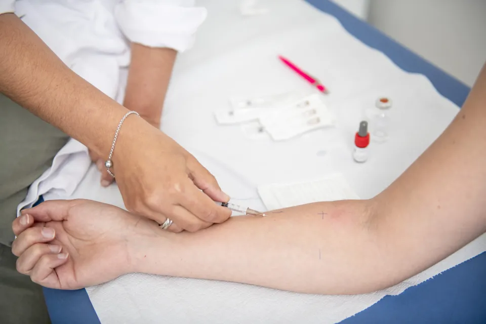 Tests cutanés et sanguins