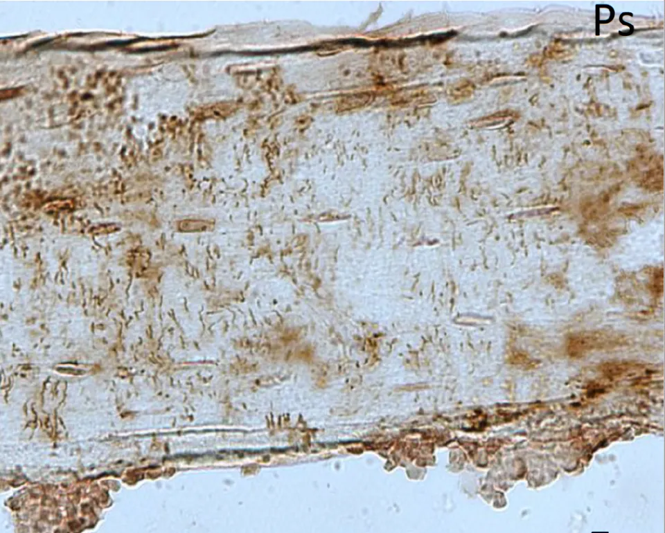 La periostine dans l’os - Copyright : HUG