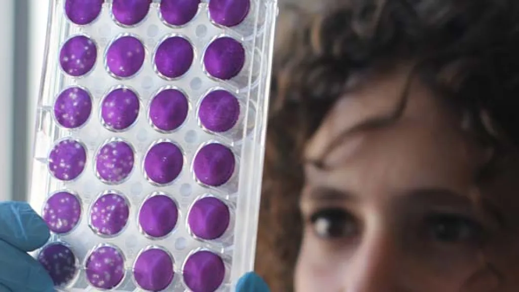 Test de neutralisation par réduction de plaque