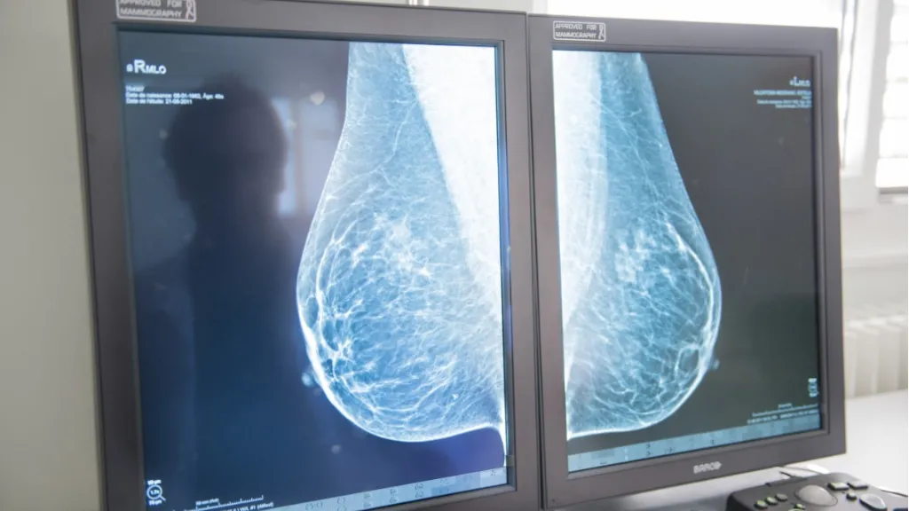 L’Hôpital de la Tour devient partenaire de réseau du Centre du sein des HUG