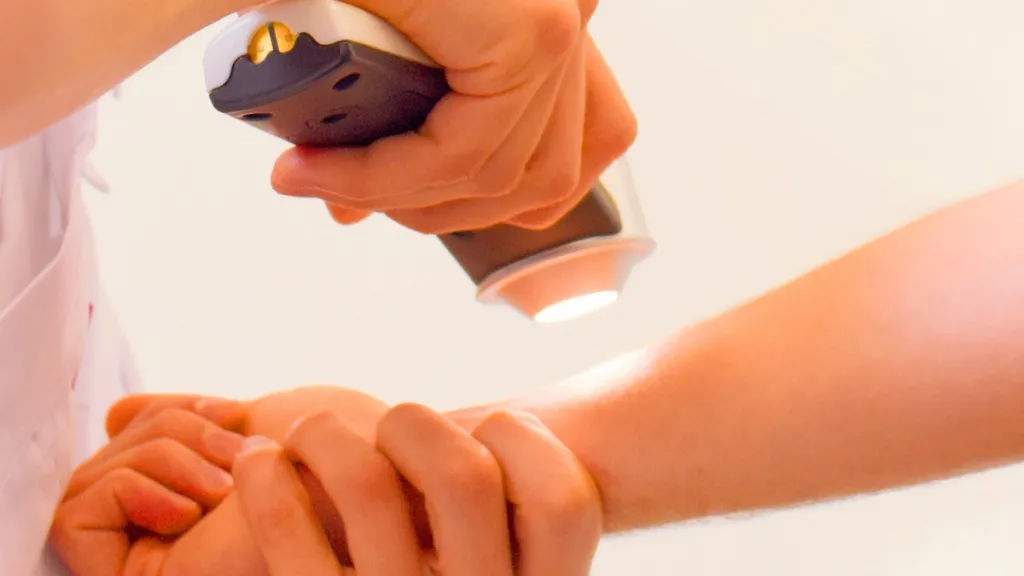 Dépistage gratuit des cancers cutanés et sensibilisation à l'auto-dépistage 