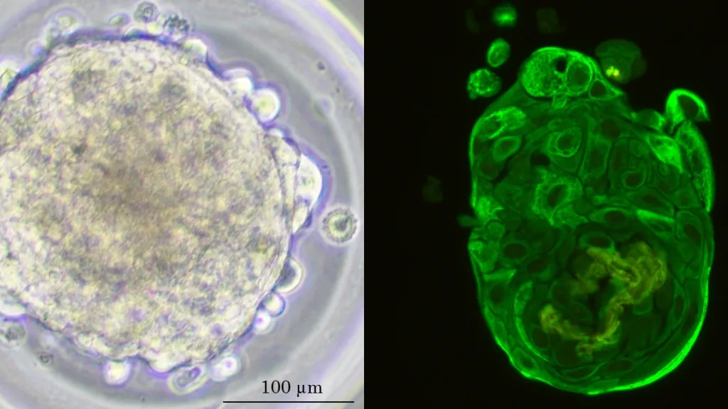 Human-derived tumor lung spheroids. Véronique Serre-Beinier, HUG, UNIGE Geneva