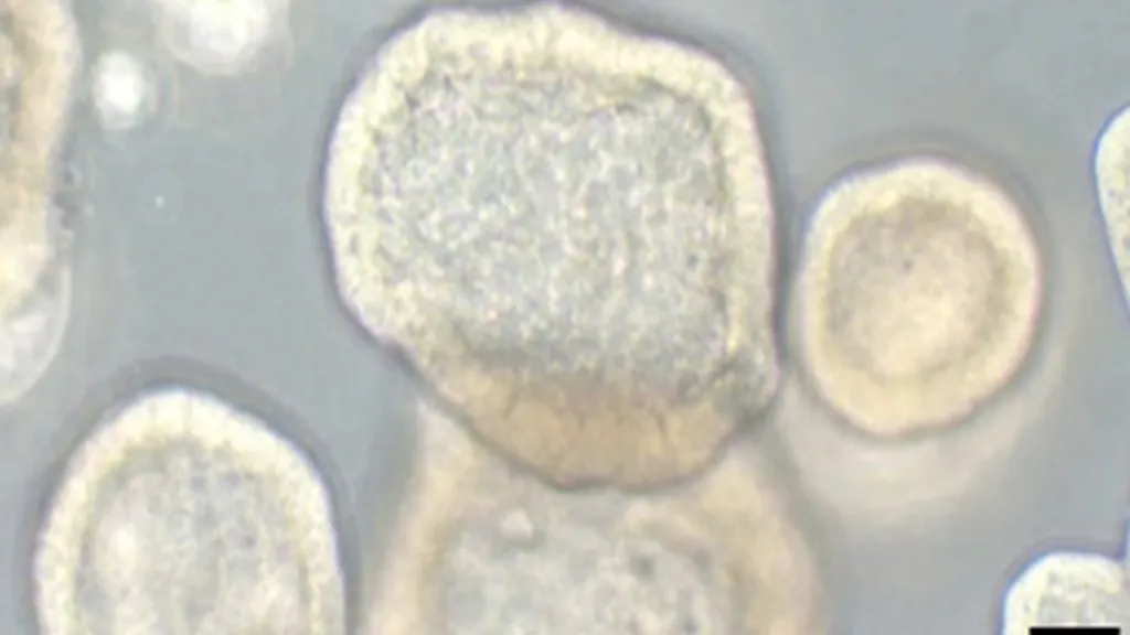 Image de cultures organoïdes 3D de cellules ovariennes cancéreuses - Université de Berne