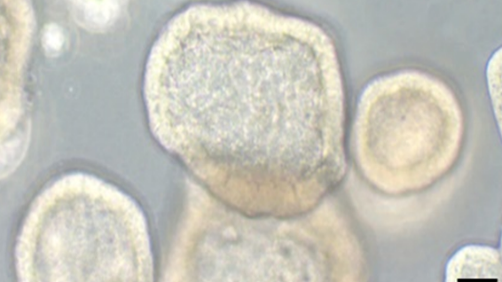 Image de cultures organoïdes 3D de cellules ovariennes cancéreuses - Université de Berne