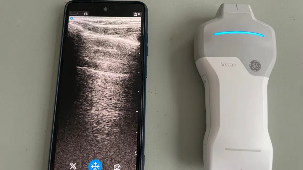 Appareil d'ultrasonographie portatif - HUG