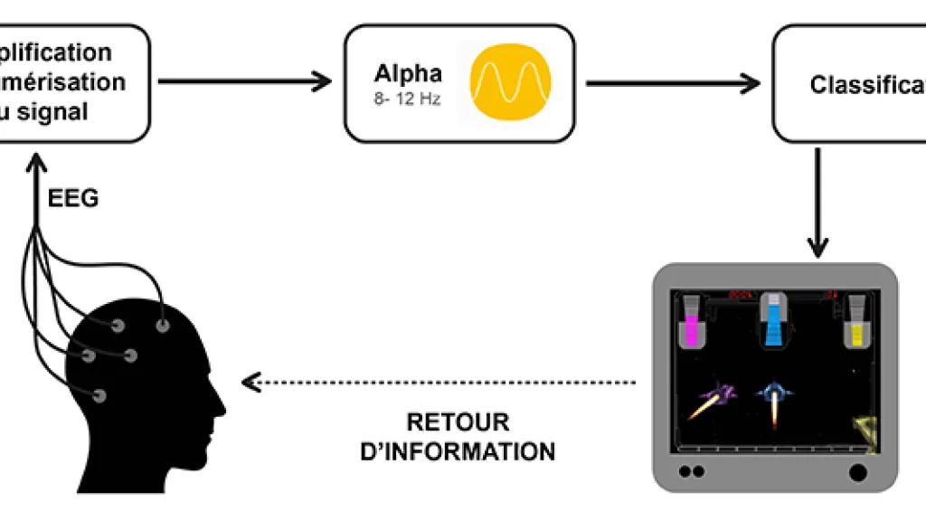 trouble de l'attention