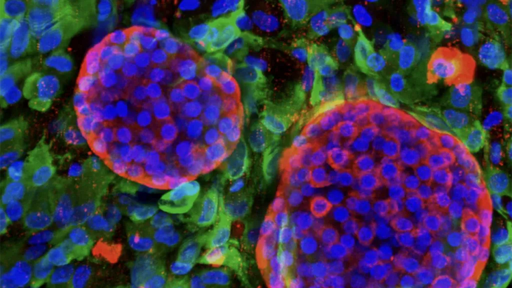 Pancréas bioartificiel vascularisé: des amas de cellules insulaires productrices d'insuline (en rouge) sont logés dans une structure souple en hydrogel peuplée de cellules endothéliales (en vert). © Berishvili Lab, University of Geneva