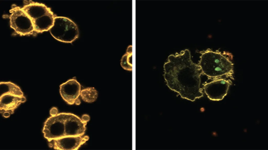 Les horloges cellulaires dans les îlots pancréatiques humaines contrôlent le fluidité membranaire © 2022 Petrenko et al. (2022) Type 2 diabetes disrupts circadian orchestration of lipid metabolism and membrane fluidity in human pancreatic islets. PLoS Biol 20(8): e3001725.