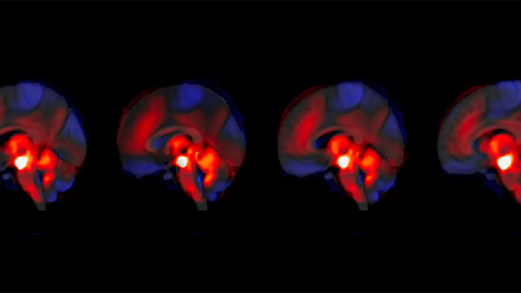 llustrative image of the connectivity between the cerebellum and the VTA. © Thomas Bolton