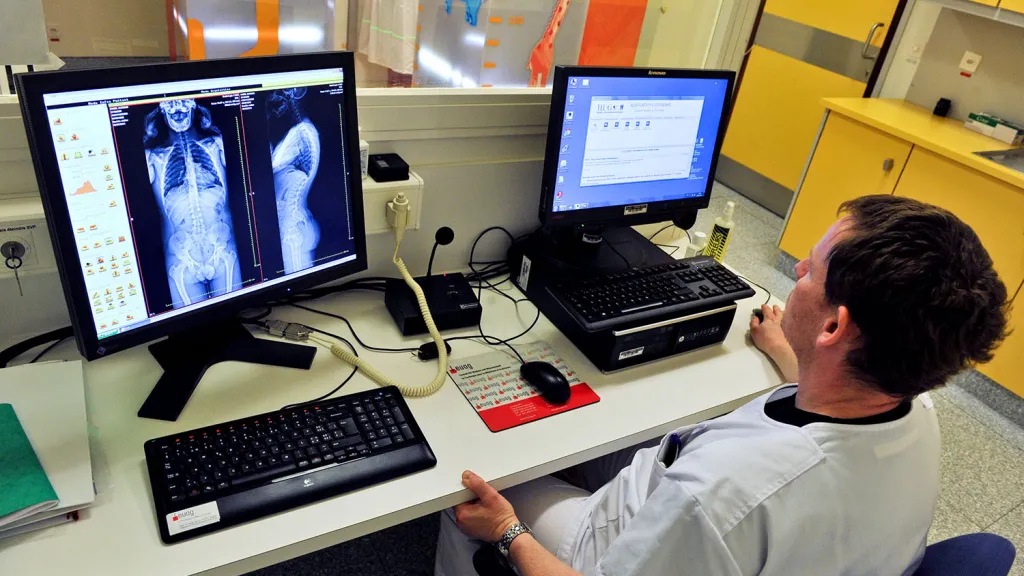 Monitor scoliosis without risk to the child