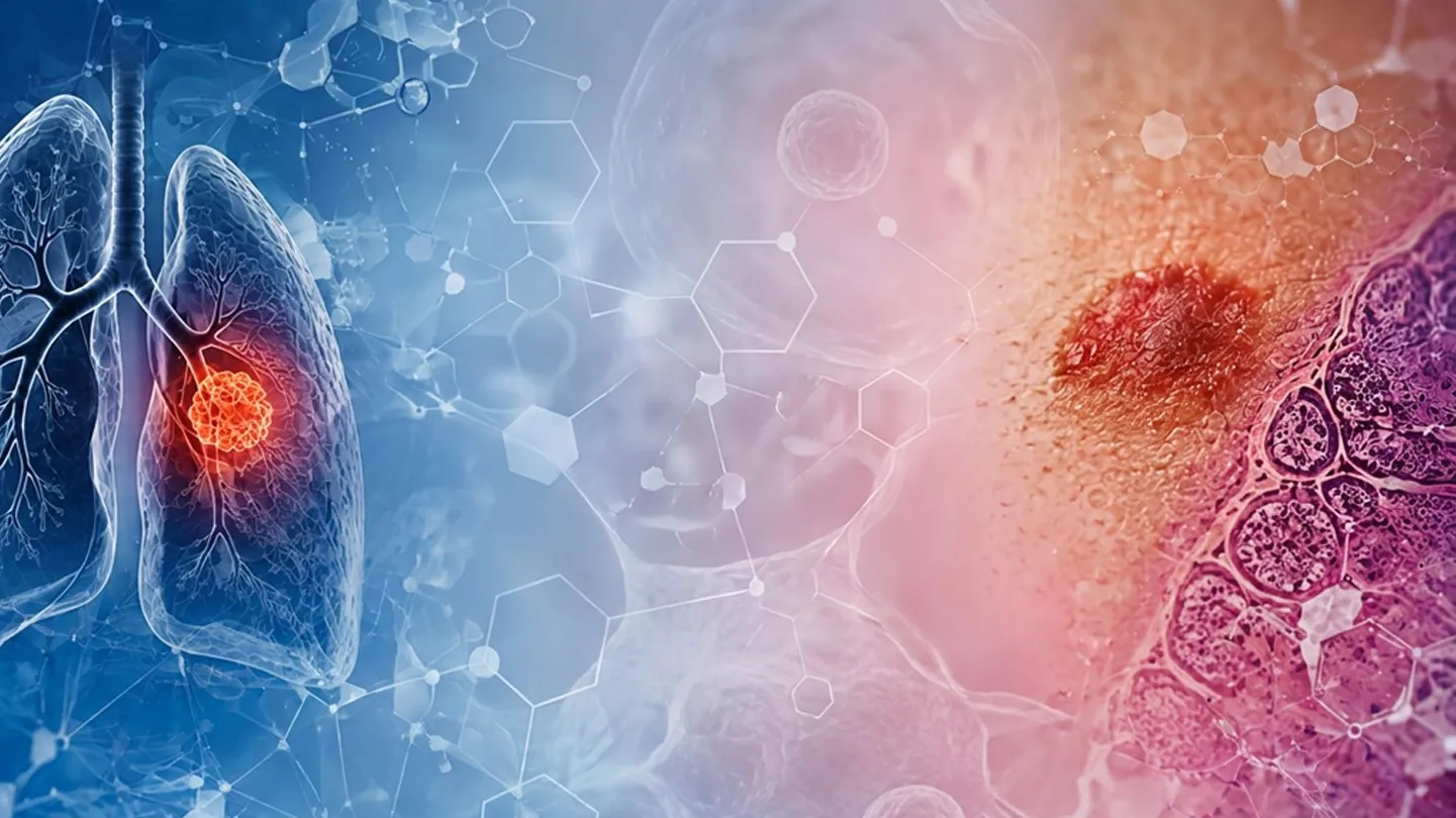Les cancers épidermoïdes au-delà de l'organe : regards croisés entre peau et poumon
