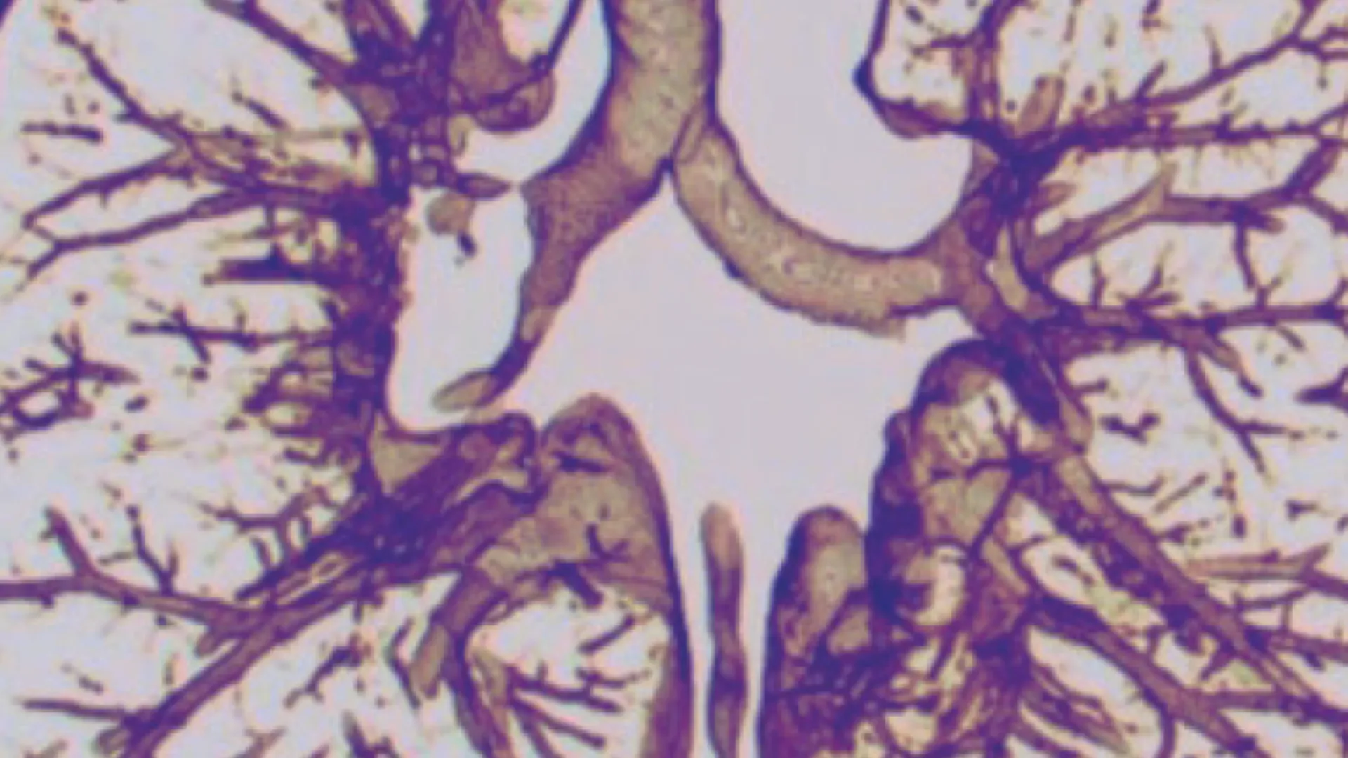 Visuel The International Lung GVHD Consensus Conference