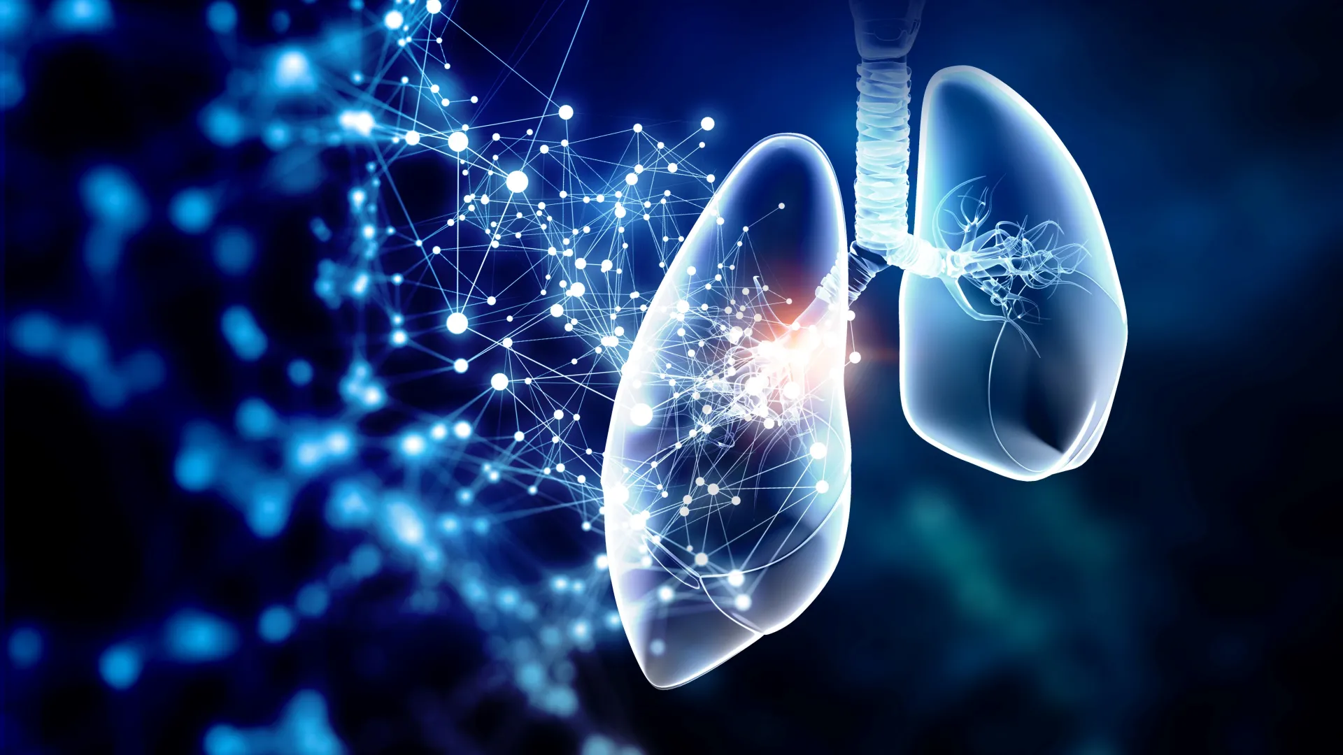 Cancer du poumon à petites cellules : thérapies émergentes et perspectives