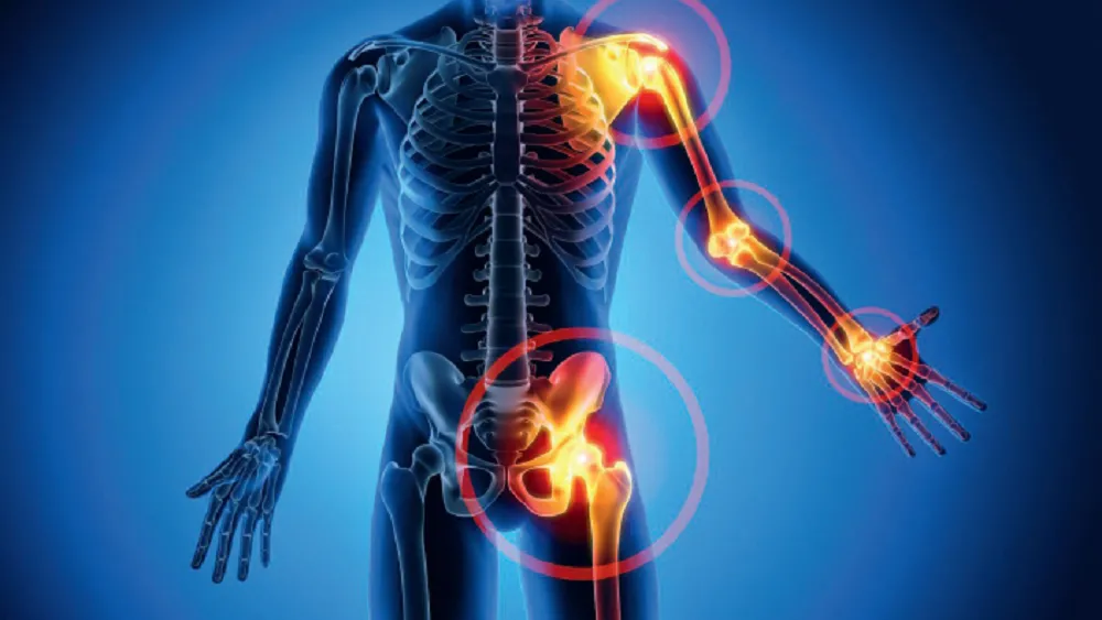 image journée romande de rhumatologie