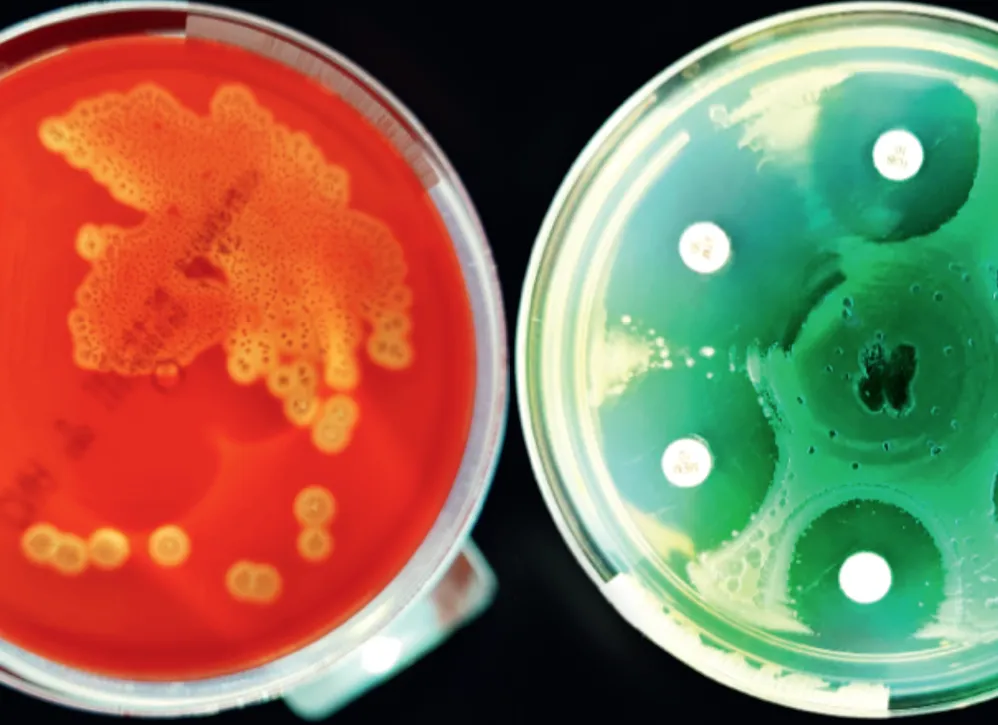 Séminaire d'infectiologie pour les praticiens et praticiennes 2023