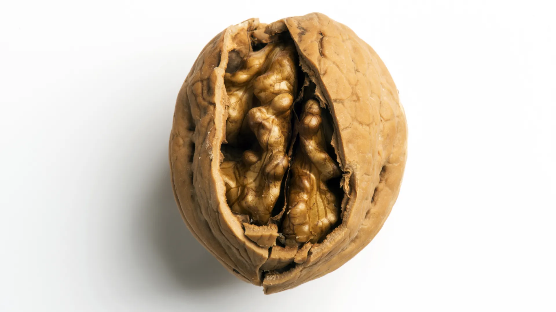 Traumatisme crânien