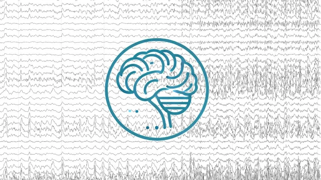 Formation épilepsie