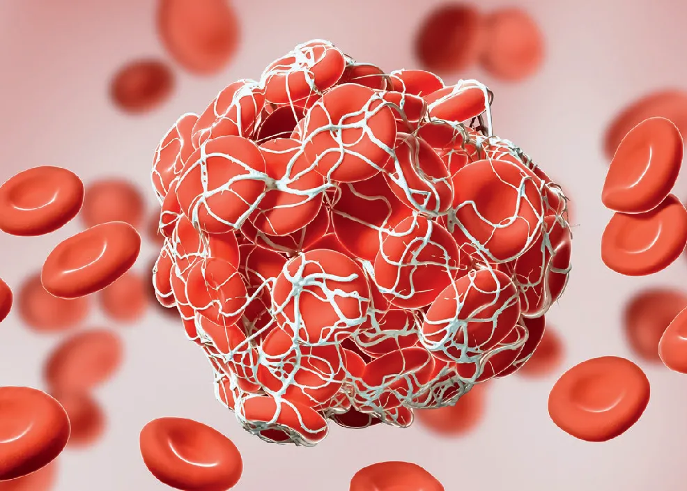 World Thrombosis Day