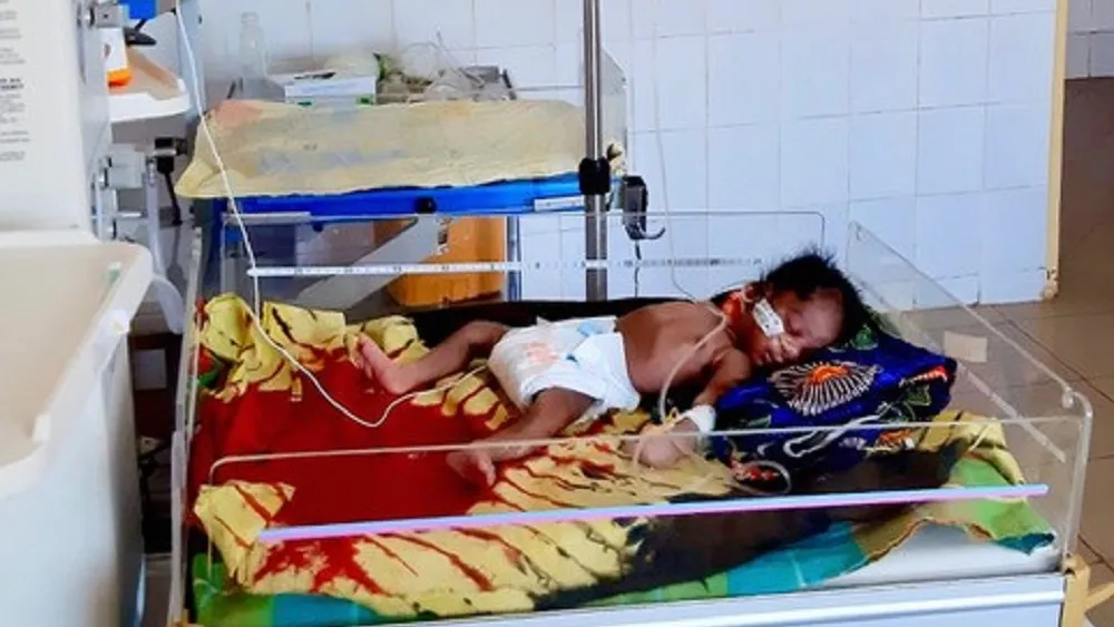 bébé en néonatologie