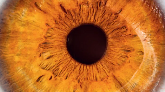 Brochure Gipp : Chalazion