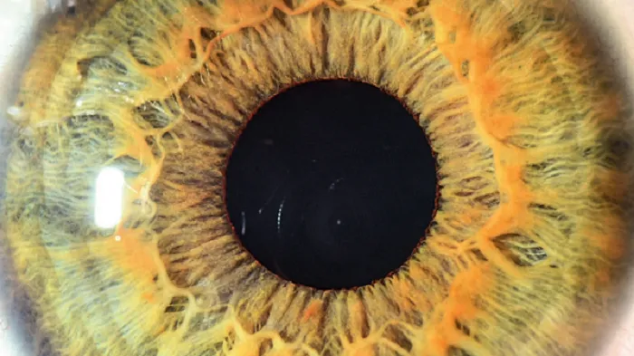 Brochure Gipp : la greffe de la cornée