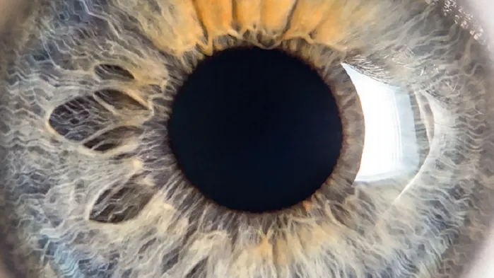 Brochure Gipp : L'obstruction des voies lacrymales chez le nourrisson